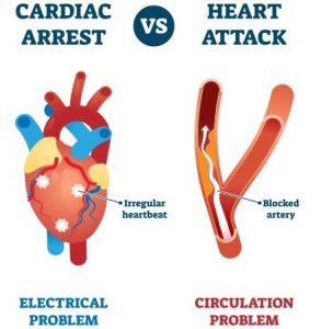 cardiac_arrest