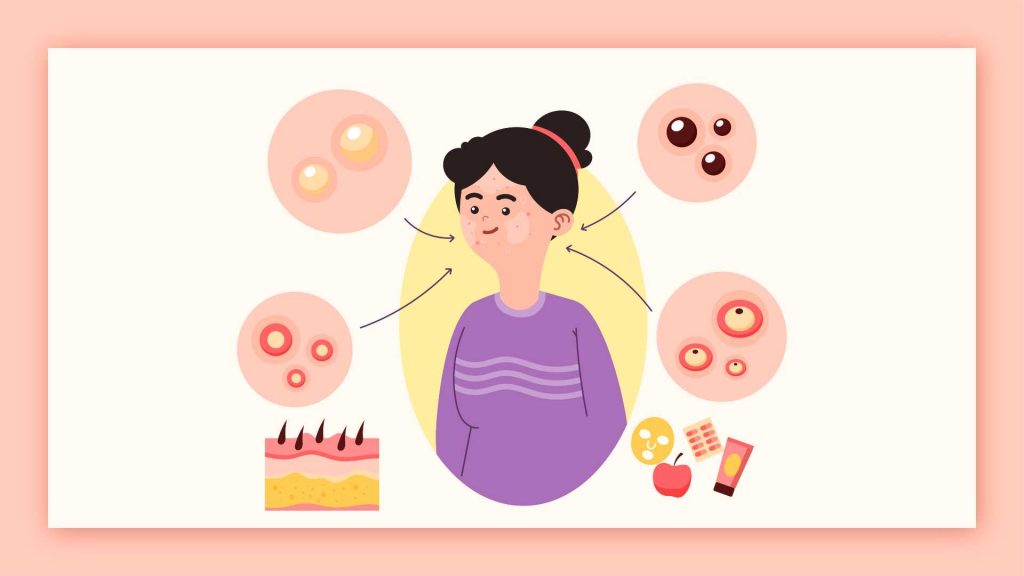 10 Best Skin Care Products for Oily Skin in the Philippines