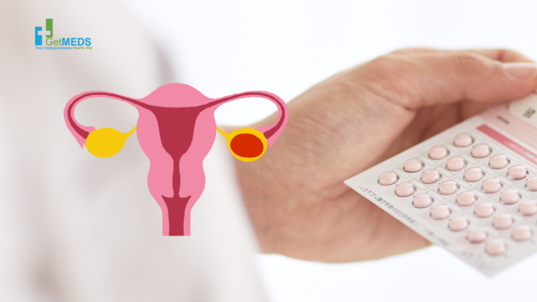 Contraceptive Pills May Lower Ovarian Cancer Risk