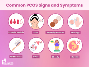 
Common PCOS Signs and Symptoms