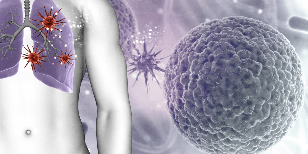Regular Screening for Lung Cancer & Why is it Important?
