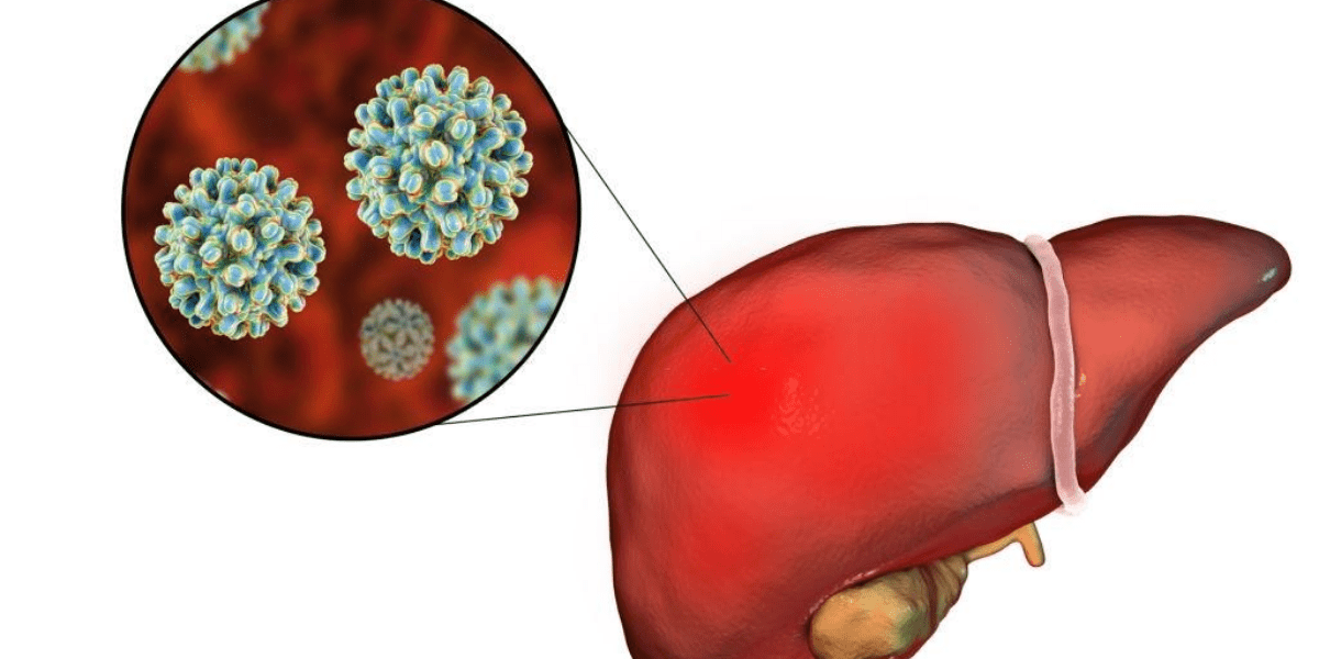 Hepatitis B: What Are the Symptoms And Signs?