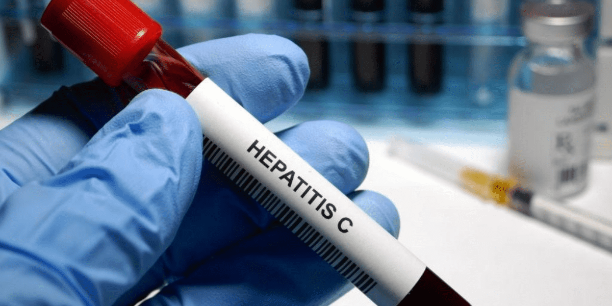 CAUSES, SYMPTOMS, PREVENTION, AND DIAGNOSIS OF HEPATITIS C