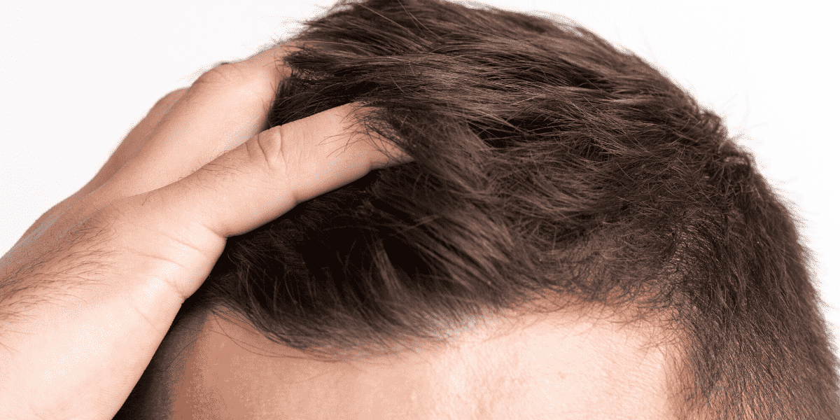Natural Ways To Fight Against Hair Loss