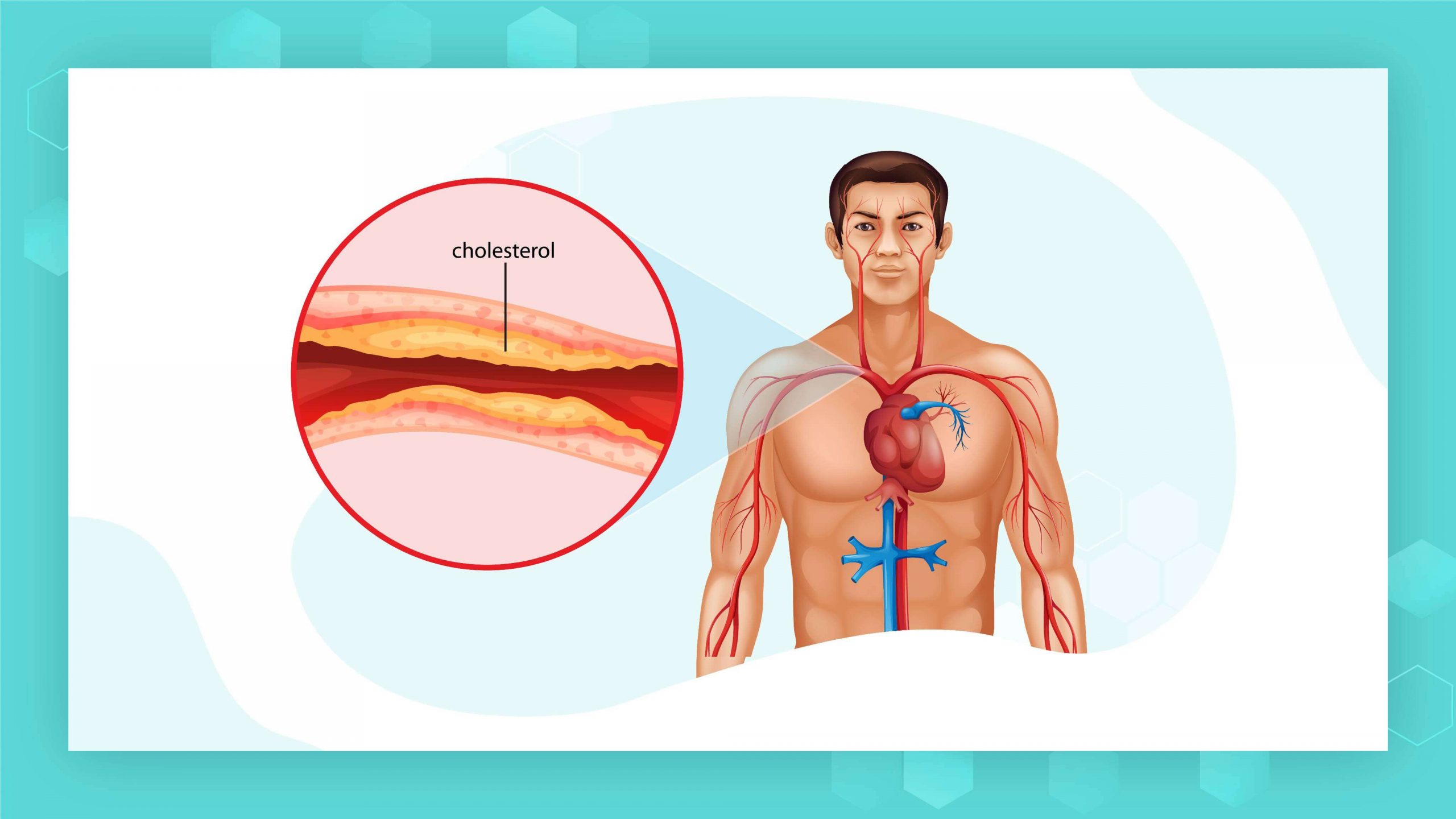What Is LDL(Low-density Lipoprotein) Cholesterol and How to Diagnose It?